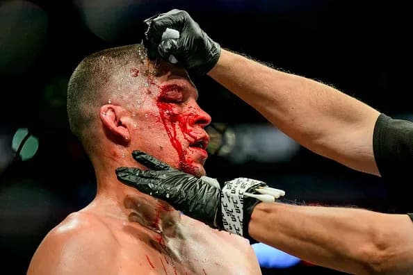UFC 244 Nathan Diaz Scar Tissue