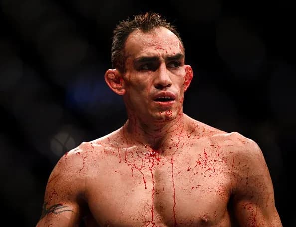 Tony Ferguson UFC 249