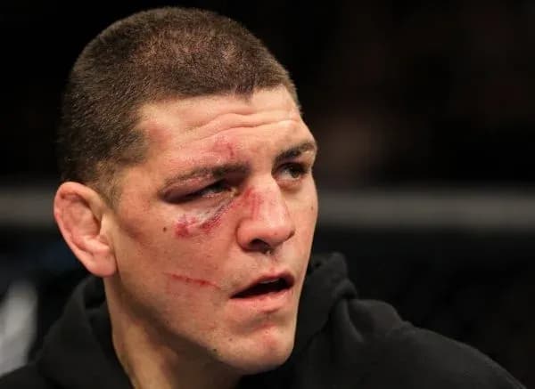 Nick Diaz Ruling