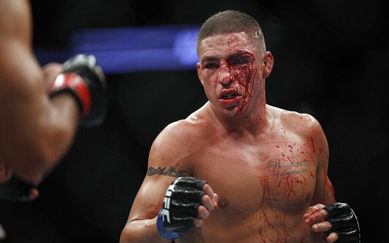 Image for Diego Sanchez forced off UFC 180 fight card due to injury
