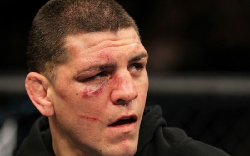 Image for Medical Cannabis Advocacy Groups Call For a Ban of NSAC Following Nick Diaz Ruling