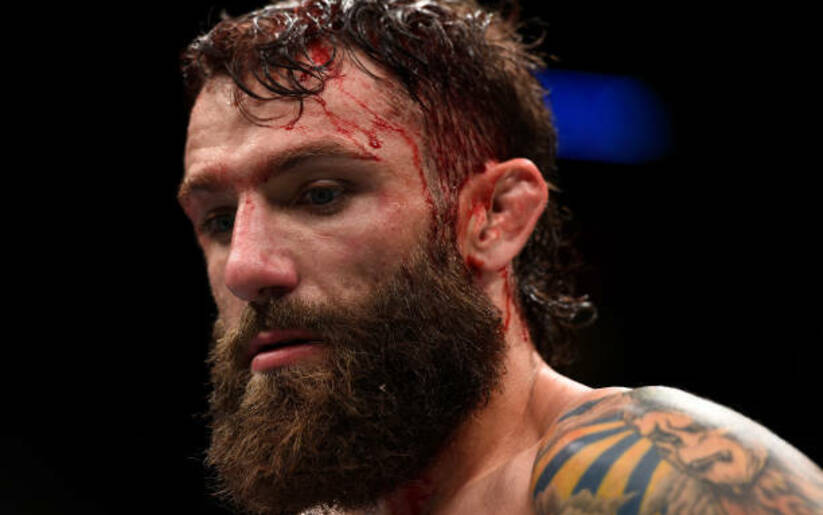 Image for Michael Chiesa Will Fight at UFC 223 Despite Face Laceration