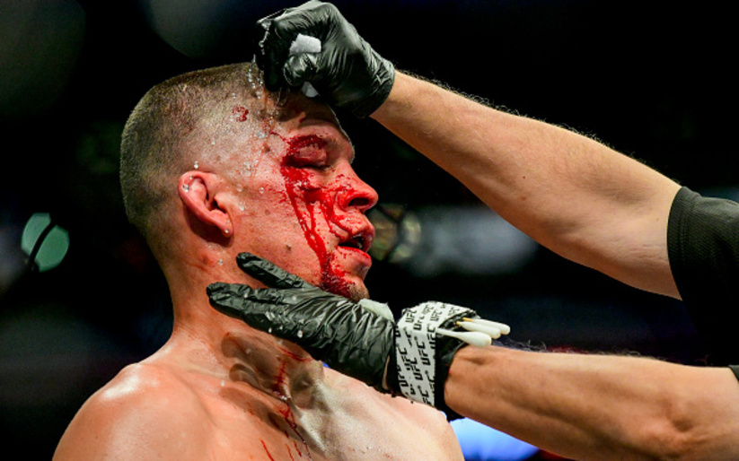 Image for UFC 279 Proves Nate Diaz Was Right All Along