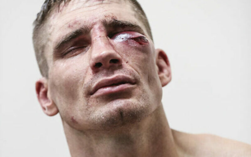 Image for Rico Verhoeven No Longer Recognized by Phone After Glory: Collision 3
