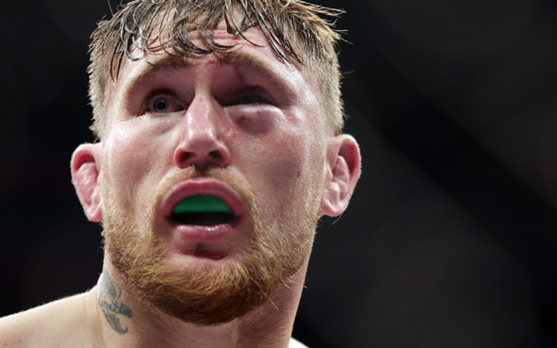 Image for Darren Till – Losing Streak and How to fix it