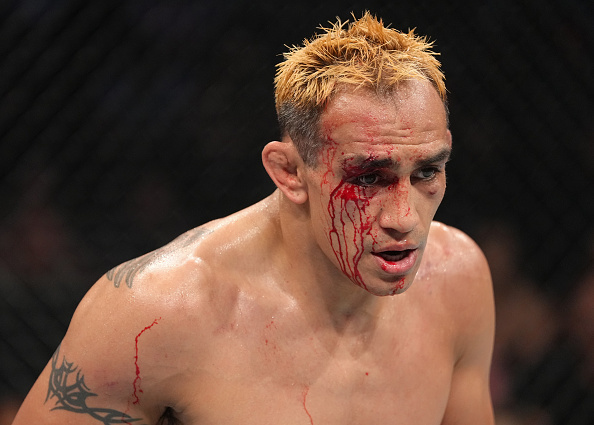 Tony Ferguson Looks to Break Five Fight Skid at UFC 291