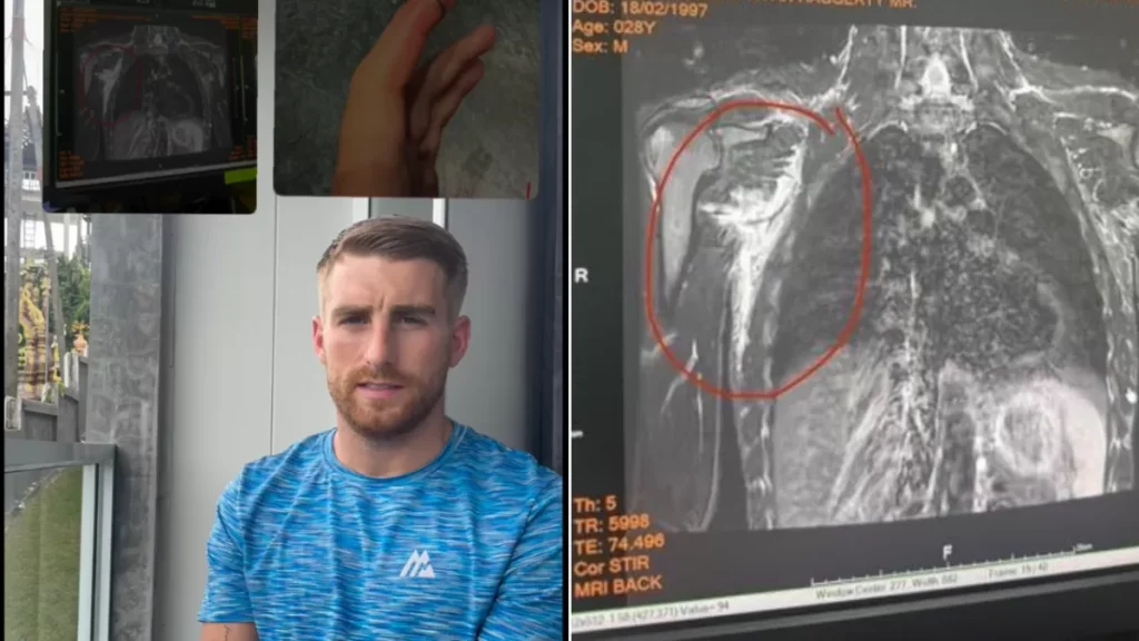 A split screen of Jonathan Haggerty detailing his injury and the X-ray of it